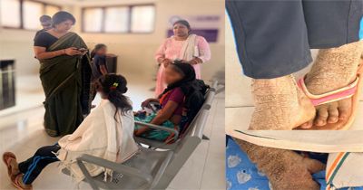 डॉ .वर्णिका की पहल से गंभीर रूप से बीमार बालिका जोगेश्वरी को मिला एम्स रायपुर में उपचार डॉ .वर्णिका की पहल से गंभीर रूप से बीमार बालिका जोगेश्वरी को मिला एम्स रायपुर में उपचार