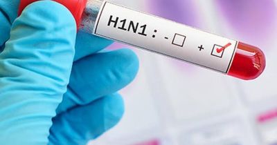 छत्तीसगढ़ के इस जिले में H1N1 की एंट्री से मचा हड़कंप, 2 साल की मासूम हुई संक्रमित; स्वास्थ्य विभाग सतर्क&hellip;..