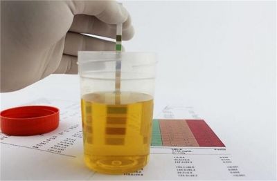 सर्दियों में क्यों बदल जाता है पेशाब का रंग? जानें कब है सामान्य और कब गंभीर बीमारी का संकेत